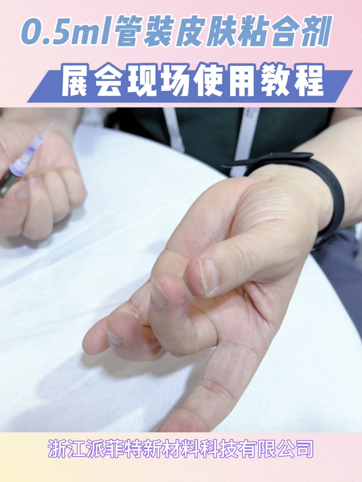 医用组织胶水粘不牢？伤口总崩开？