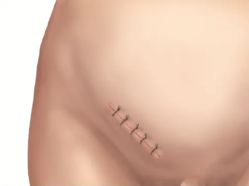 640 (1).png